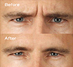 Before & After Photos
